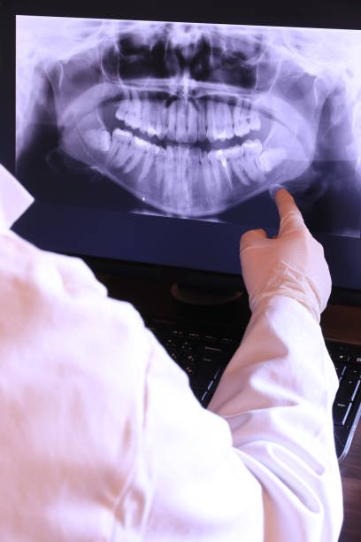 Best Knocked-Out Tooth (Avulsed Tooth) Treatment in Monticello, LA