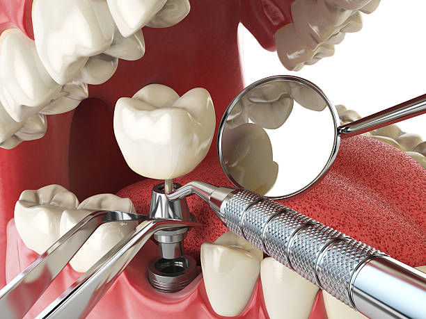 Best Emergency Care for Gum Disease in Monticello, LA
